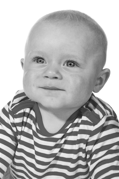 ˫��Ƥ��ĸ����������Ƥ������